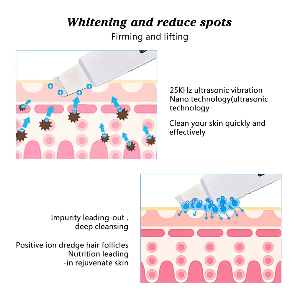 Ultrasonic Skin Scrubber & Pore Cleaner – Deep Facial Cleansing Tool