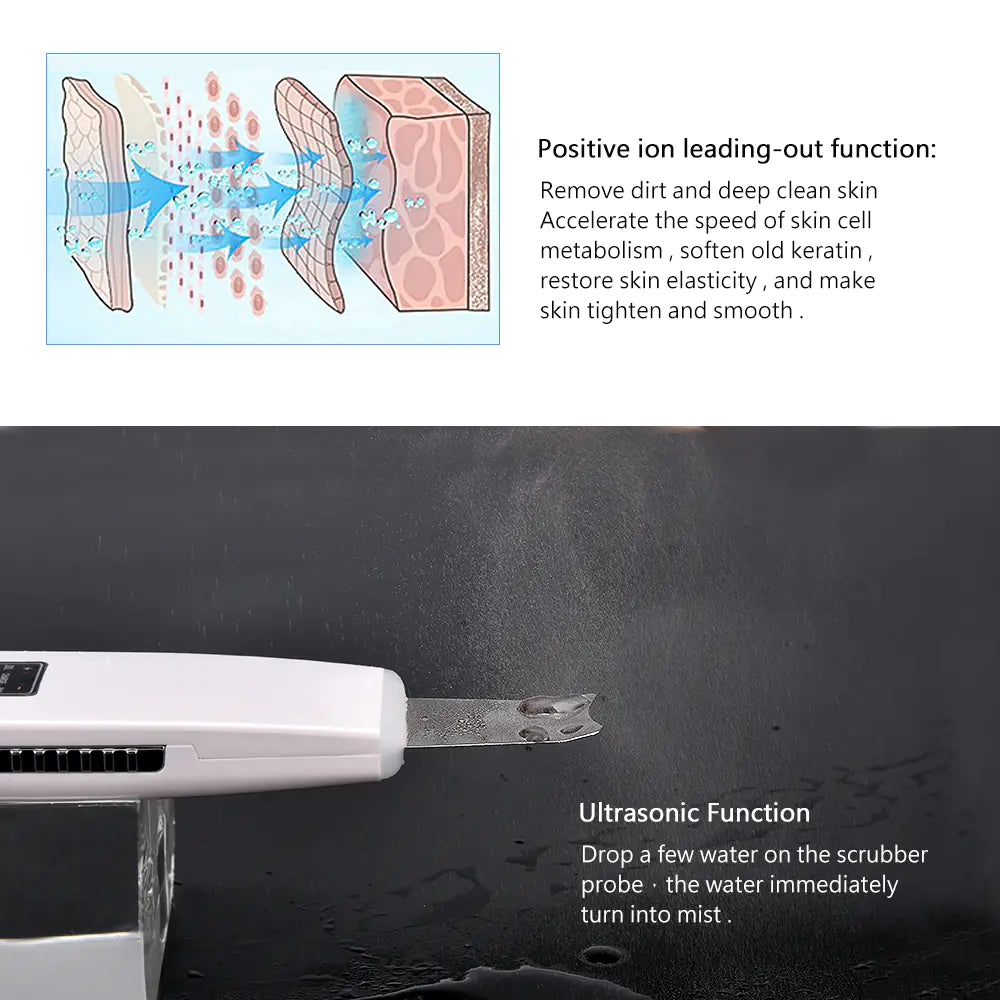 Ultrasonic Skin Scrubber & Pore Cleaner – Deep Facial Cleansing Tool